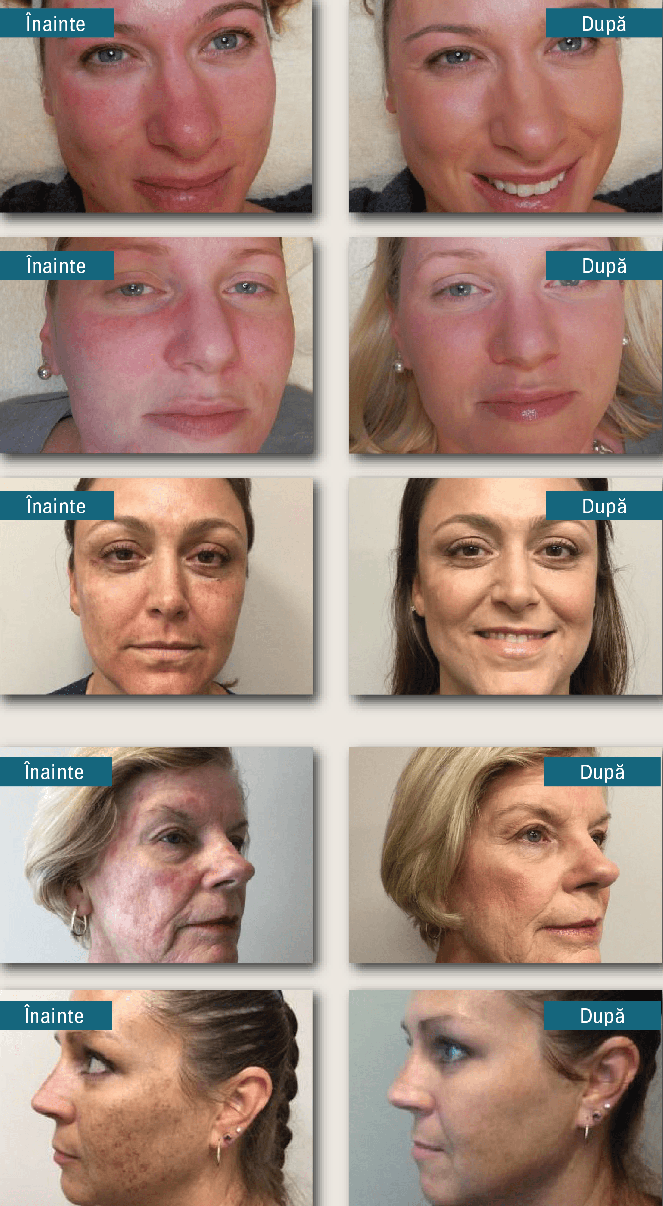 CC Cream SPF 50 Face Shield Flex Colorescience - imagine 4